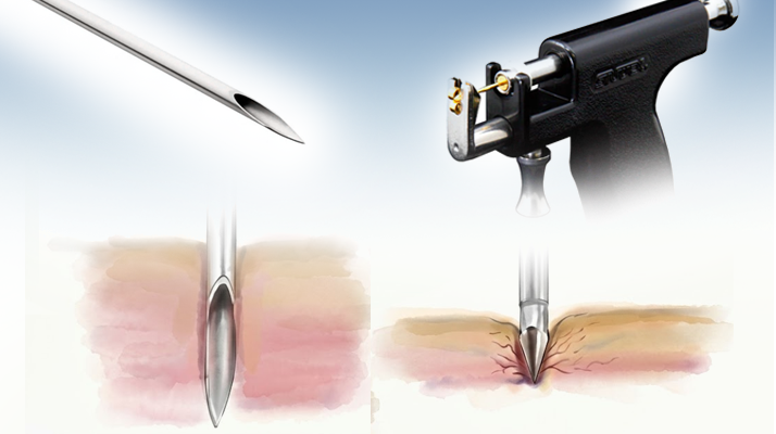 Needle vs Gun Comparison